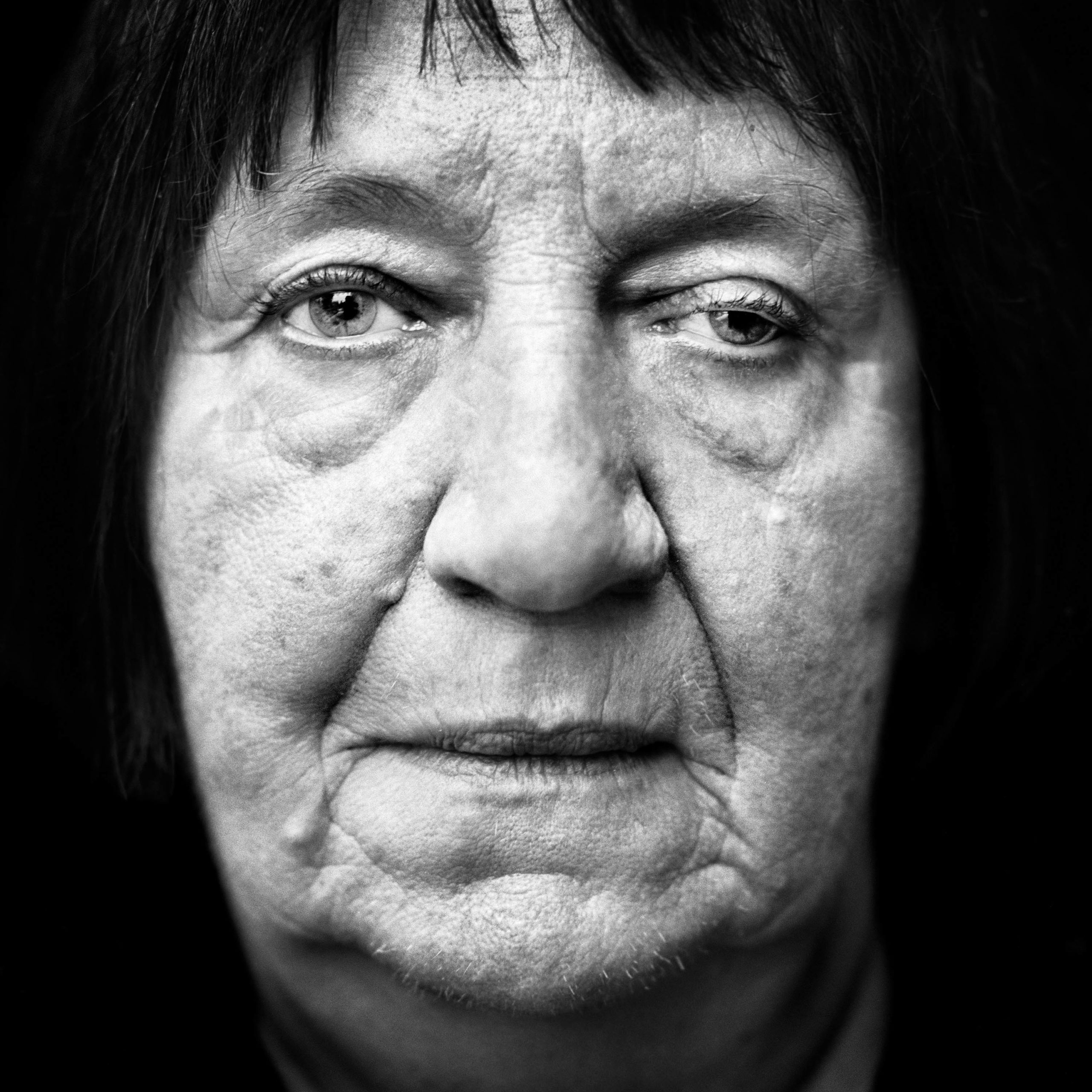 Helene Boppert (Germany, 1938). Interview outtake: “The Americans dropped incendiary bombs on our street. Sixty-five people were killed. My father was killed, and both my brothers were killed. I was unconscious when slave laborers rescued me from our burning house. Both my legs were broken, and I could hardly see a thing.”